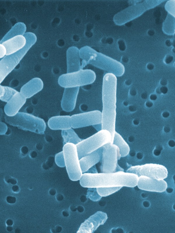 Lactobacillus Reuteri (แล็กโทบาซิลลัส&nbsp;รียูเทอรี)